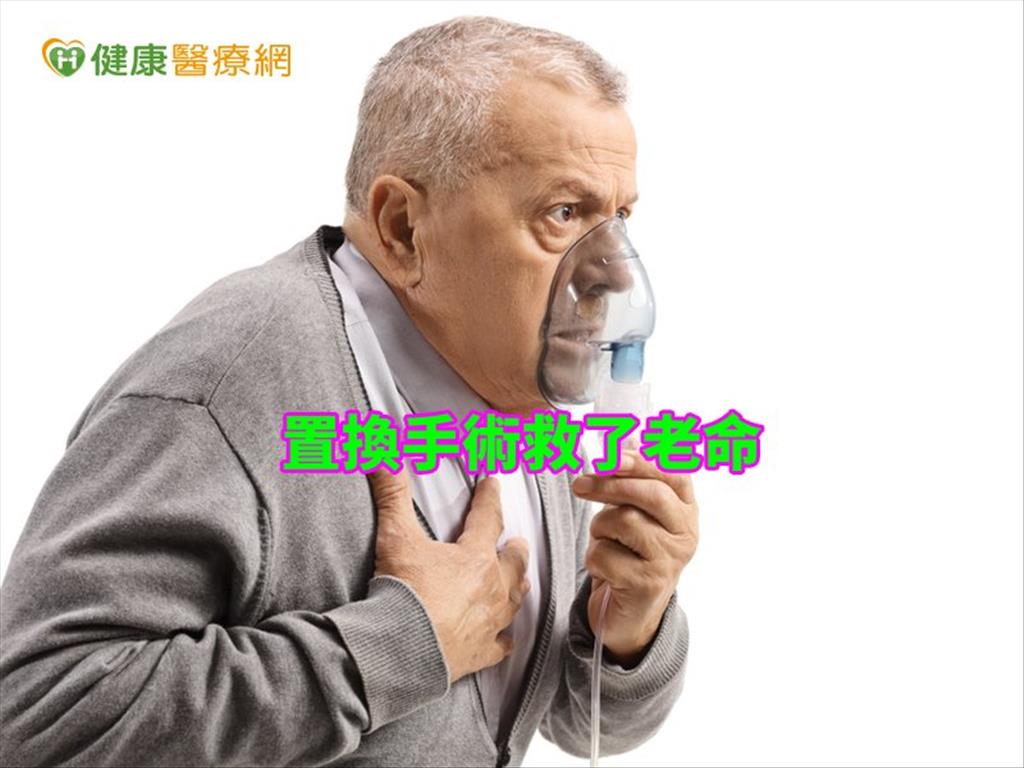 86歲翁主動脈瓣膜狹窄　置換手術救了老命