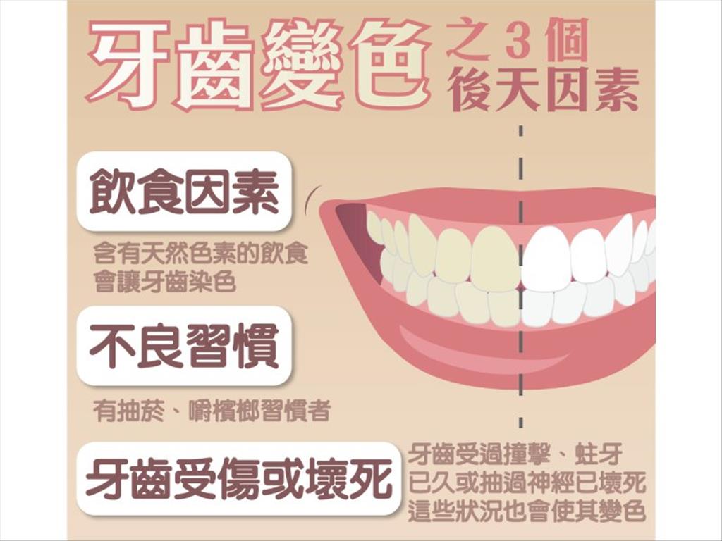 年紀大牙齒就變色？　牙醫揭密３大原因