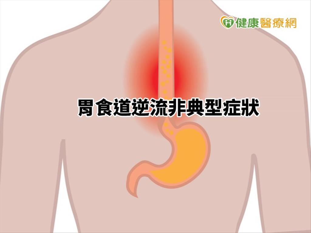 口臭又鴨嗓　「火燒心」罹癌風險高？