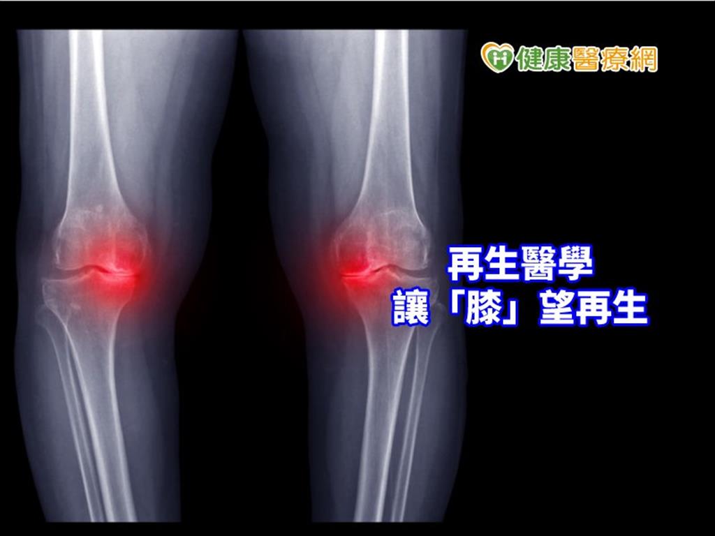 再生醫學中的黃金　重燃新「膝」望