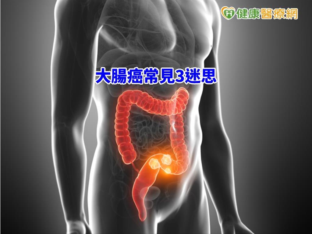 大腸癌常見3迷思　專科醫師一次說清楚