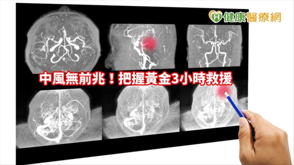 中風無前兆！把握黃金3小時救援