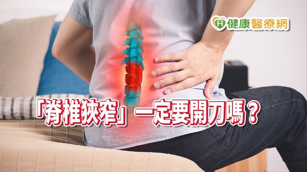 腰痛腿麻、走不動　「脊椎狹窄」一定要開刀嗎？