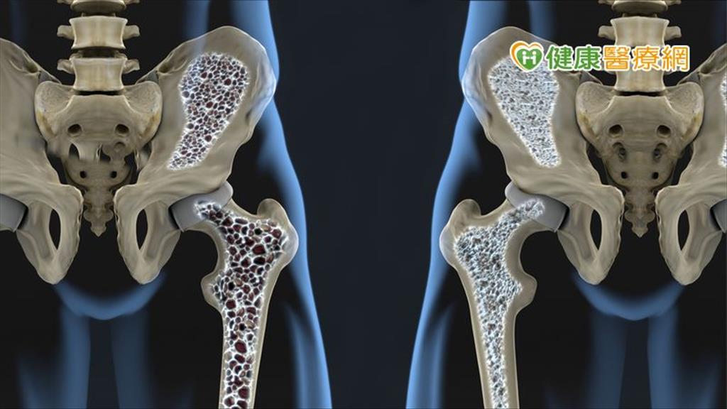 龜鹿二仙膠治骨鬆？　強筋絡、骨骼中醫這樣用