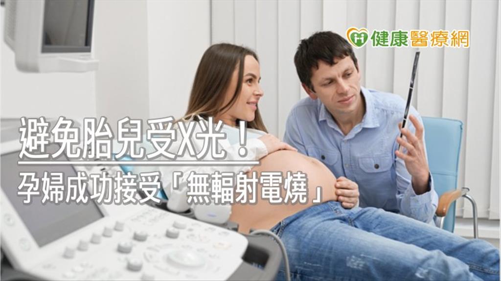 避免胎兒受X光！　孕婦成功接受「無輻射電燒」