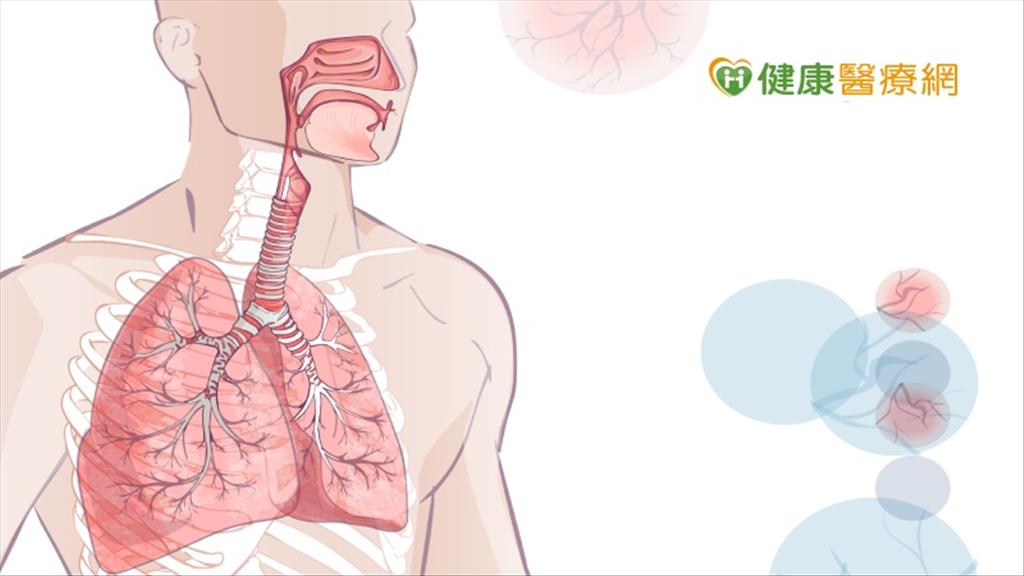 新冠肺炎輕症變重症　胸腔科醫師：呼吸道微環境很關鍵